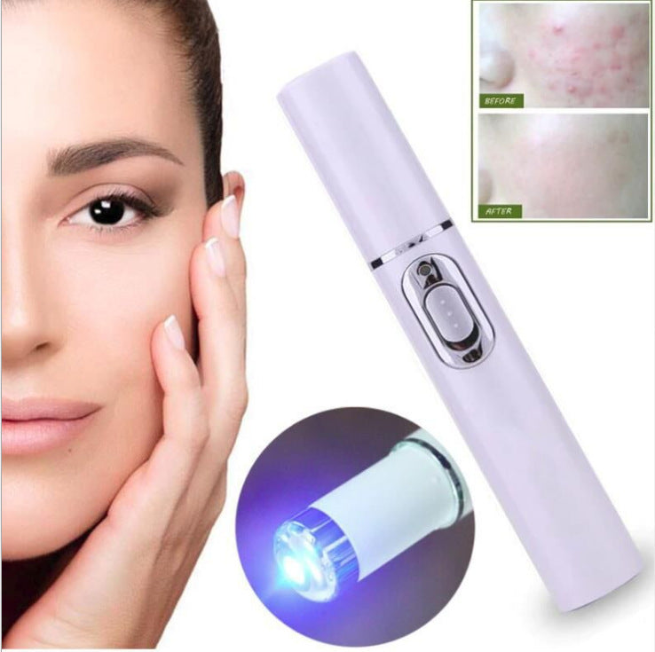 Acne Laser Pen – Blue Light Therapy Wrinkle Remover & Scar Treatment Device