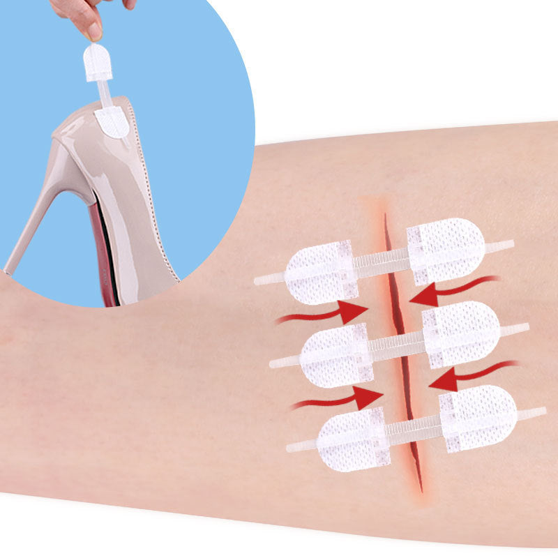 Household Self-Adhesive Bandage Stickers – Stitch-Free Medical Wound Care Tape